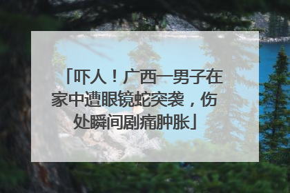 吓人！广西一男子在家中遭眼镜蛇突袭，伤处瞬间剧痛肿胀